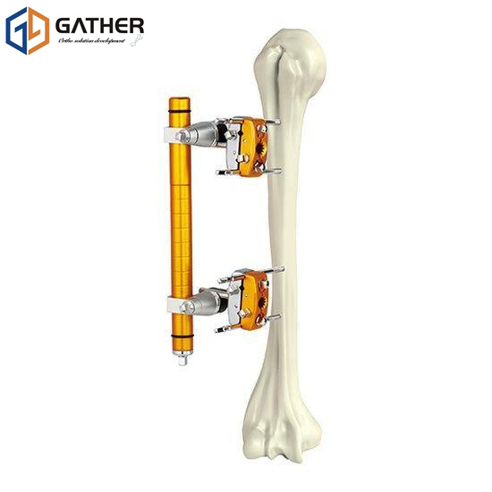 Fracture Fixation Stainless Surgical Instrument Carbon Fiber External Fixator