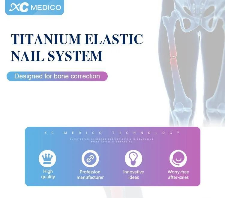 Titanium Elastic Intramedullary Nail