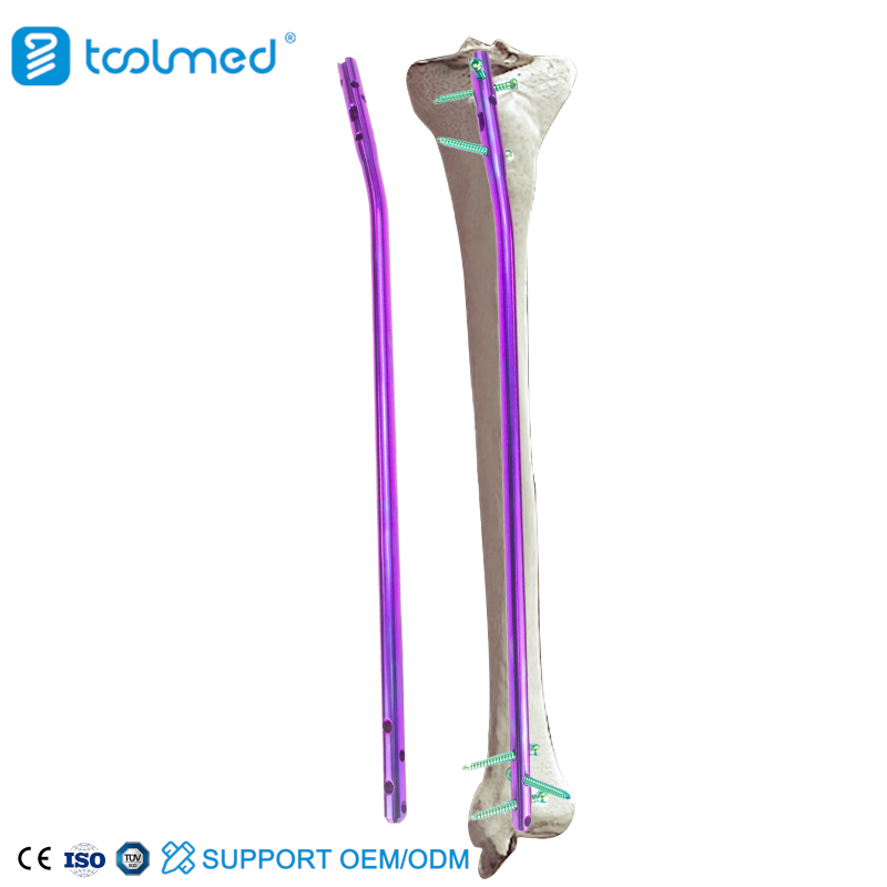 Intramedullary Nailing of Tibia Assured Quality Expert Tibia Intramedullary Nail Instrument Set