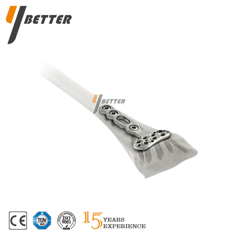 Orthopedic Implants Locking Plate Multi Axial for Distal Radius Fracture Cheap Price Factory