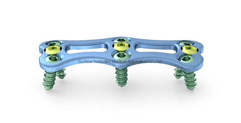 Anterior Cervicle Plate Detail