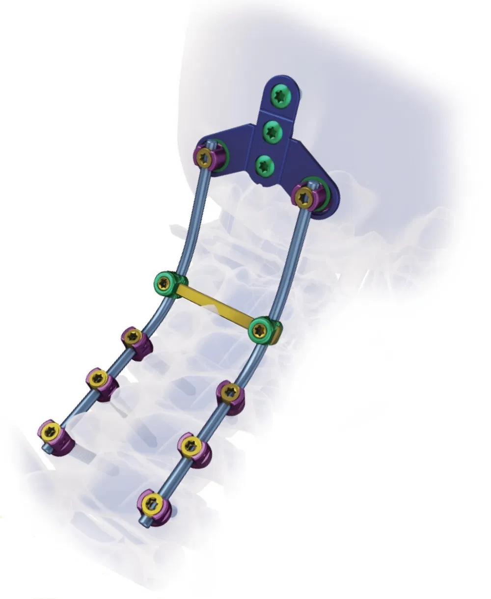 Posterior Cervical Surgery Instruments