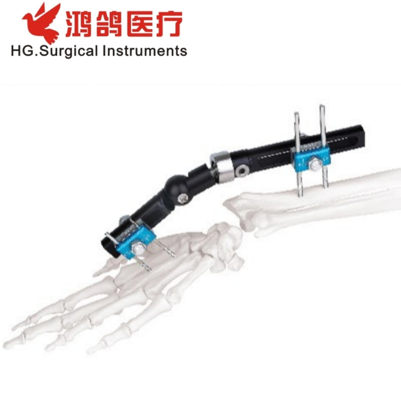 Orthopedic Wrist External Fixator Multiple Type Hospital Equipment Medical Supply Orthopedic Products