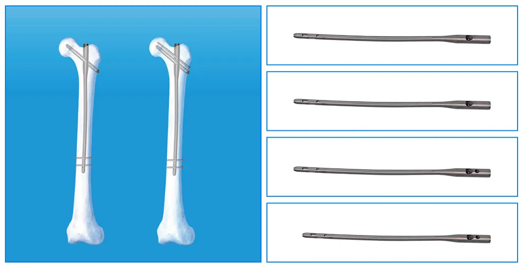 Gamma C Nail Details