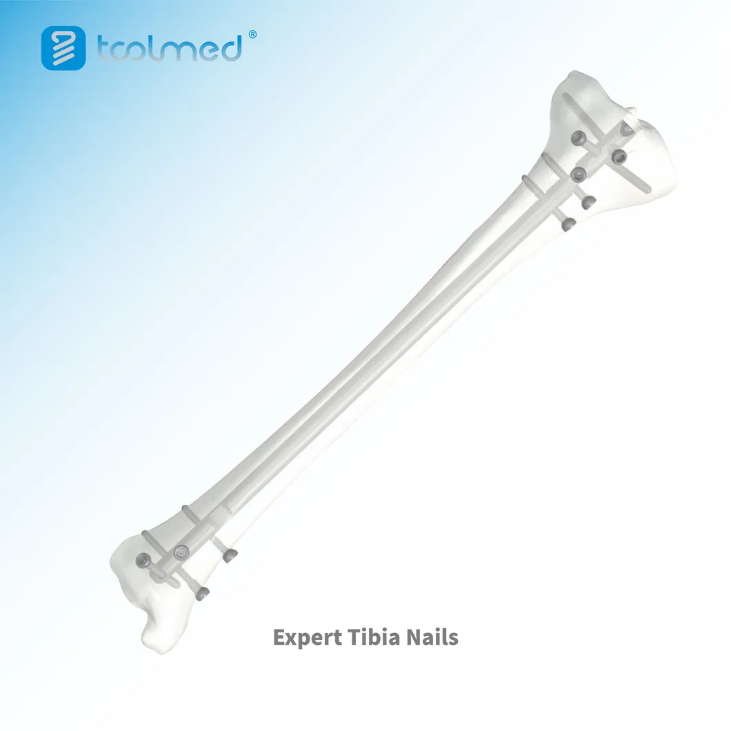 Tibia Intramedullary Nail 1