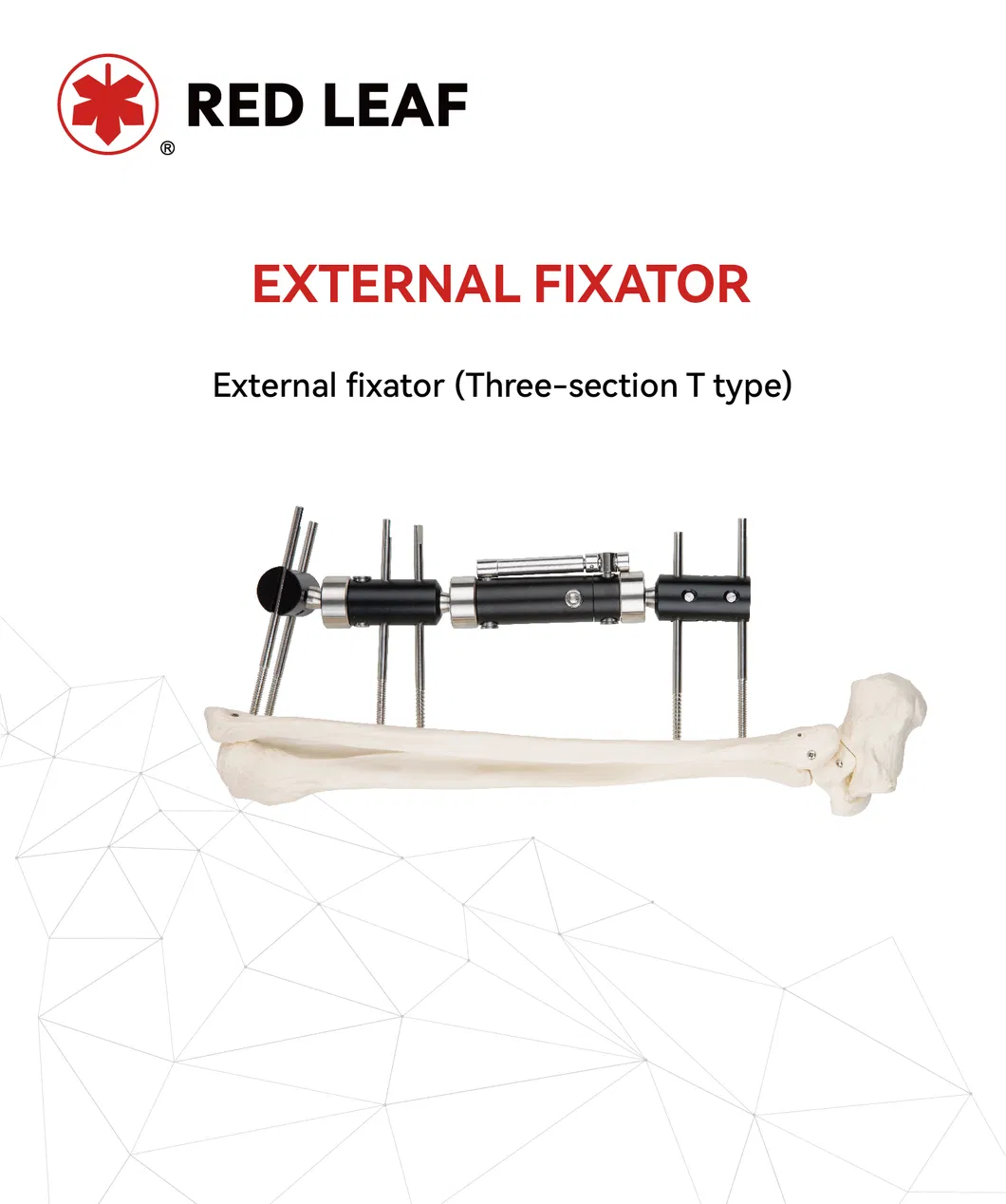 Orthopedic External Fixator Device