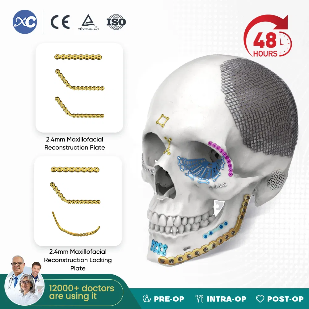 Cmf Maxillofacial Orthopedic Implant Titanium Maxillofacial 2.4mm Reconstruction Plate /Locking Plate