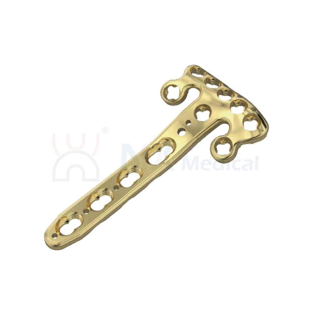 Nx Medical Variable Angle Locking Compression Plate Radius Fragment System for Orthopedic