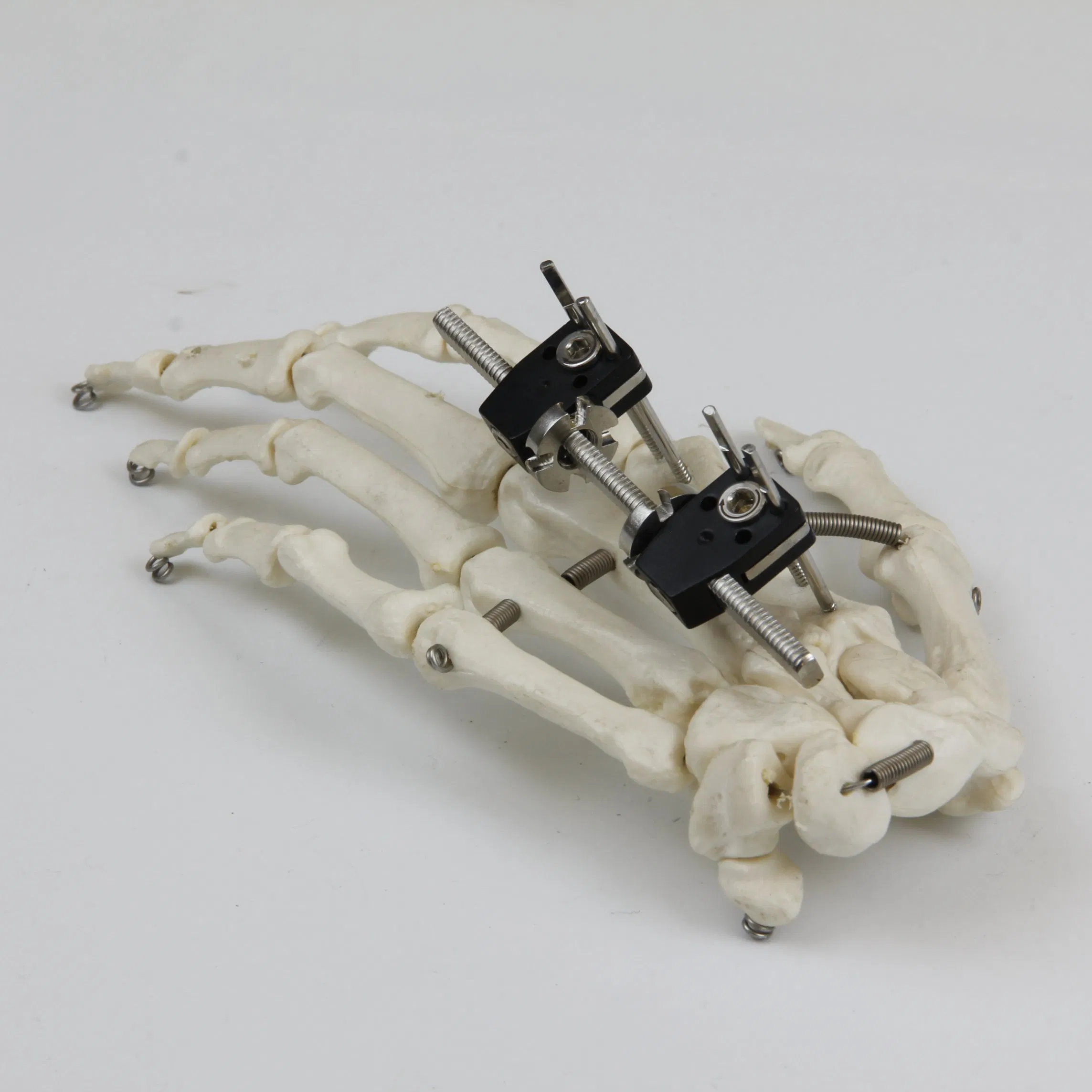 Universal Mini Palm External Fixator for Finger Fracture Orthopedic Surgical