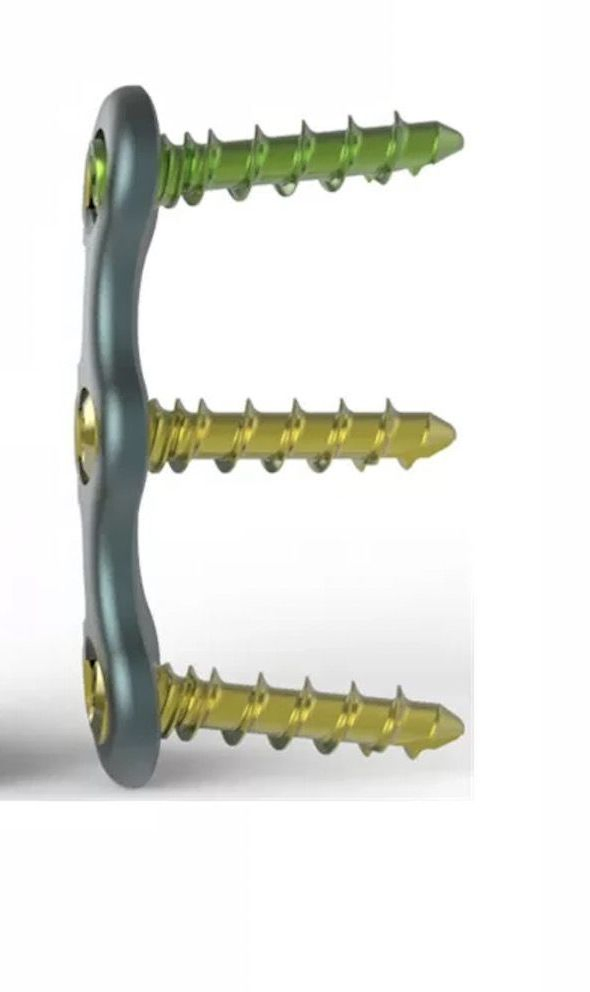 Anterior Cervical Fixation System with Screw for Cervical Spine with CE Certificate