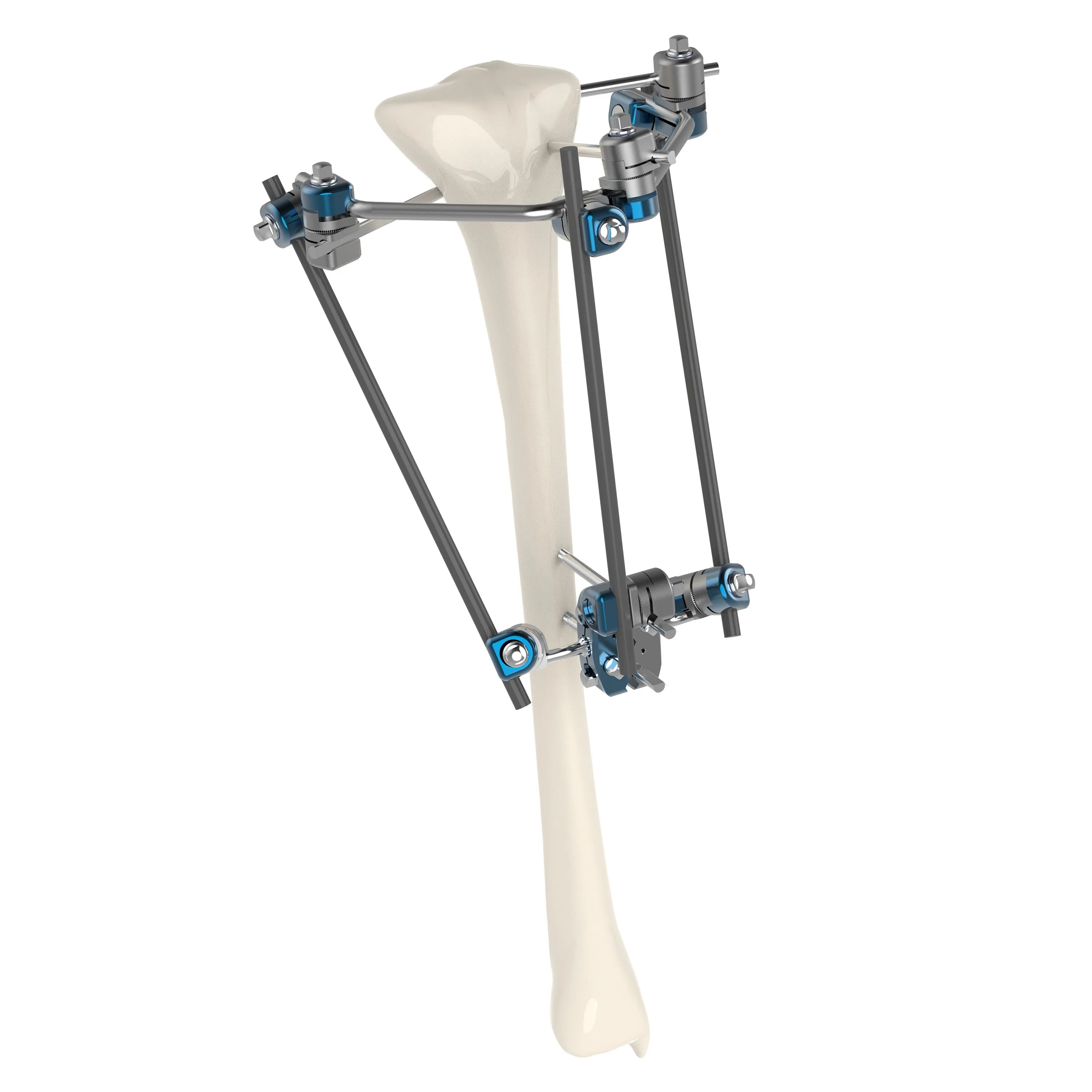 Canwell Orthopedic Trauma Implant Ilizarov Ring Fixator External Fixator Ilizarov External Fixation