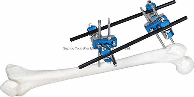 Strong External Fixator for Bone Fixation, White &amp; Black, Titanium Alloy
