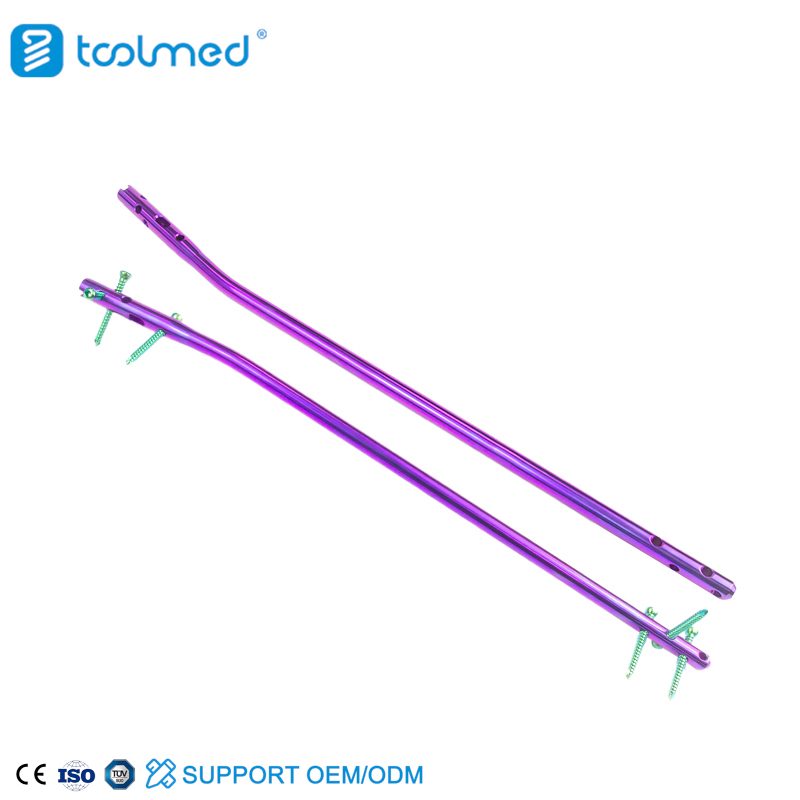 Intramedullary Nailing of Tibia Assured Quality Expert Tibia Intramedullary Nail Instrument Set