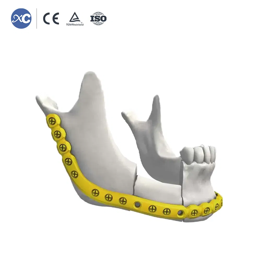 Cmf Maxillofacial Orthopedic Implant Titanium Maxillofacial 2.4mm Reconstruction Plate /Locking Plate