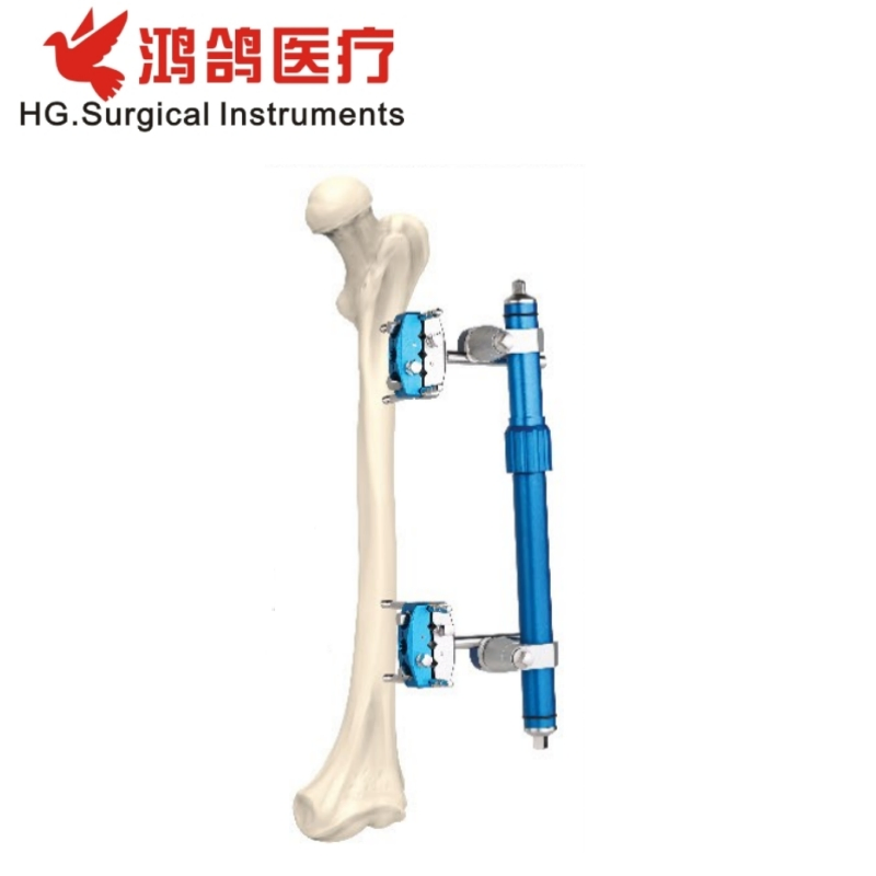 Orthopedic Instrument Combination External Fixator Ankle Fusion Joint Fixator