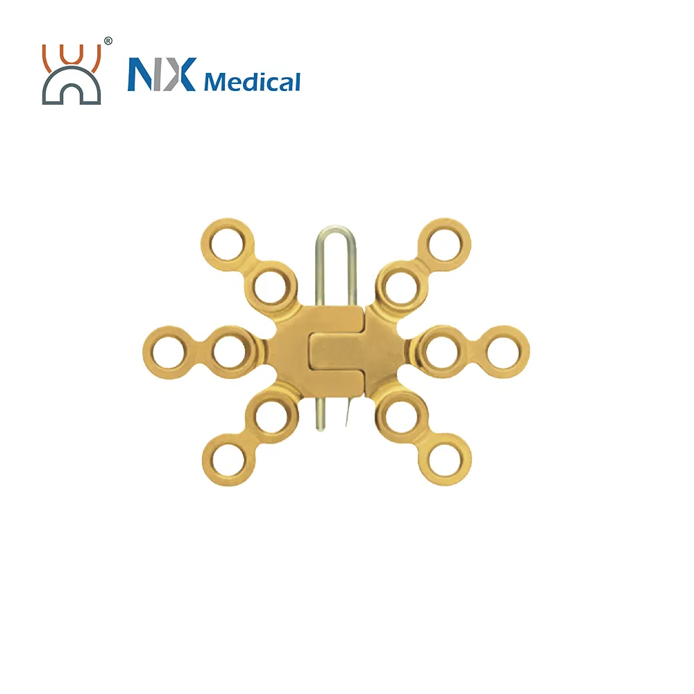 Nx Medical Locking Plates LCP Sternum 2.9mm System Implants for Orthopedic Fixation