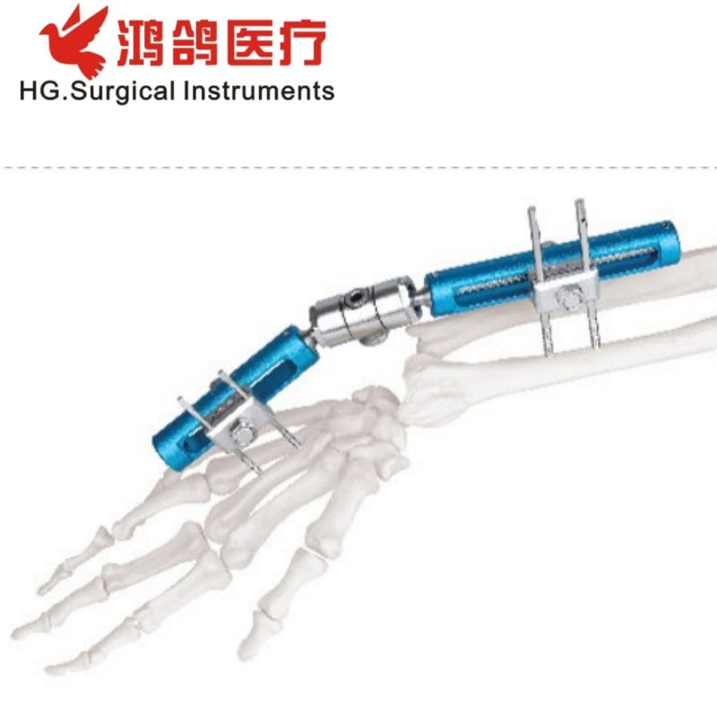 Orthopedic Wrist External Fixator Multiple Type Hospital Equipment Medical Supply Orthopedic Products