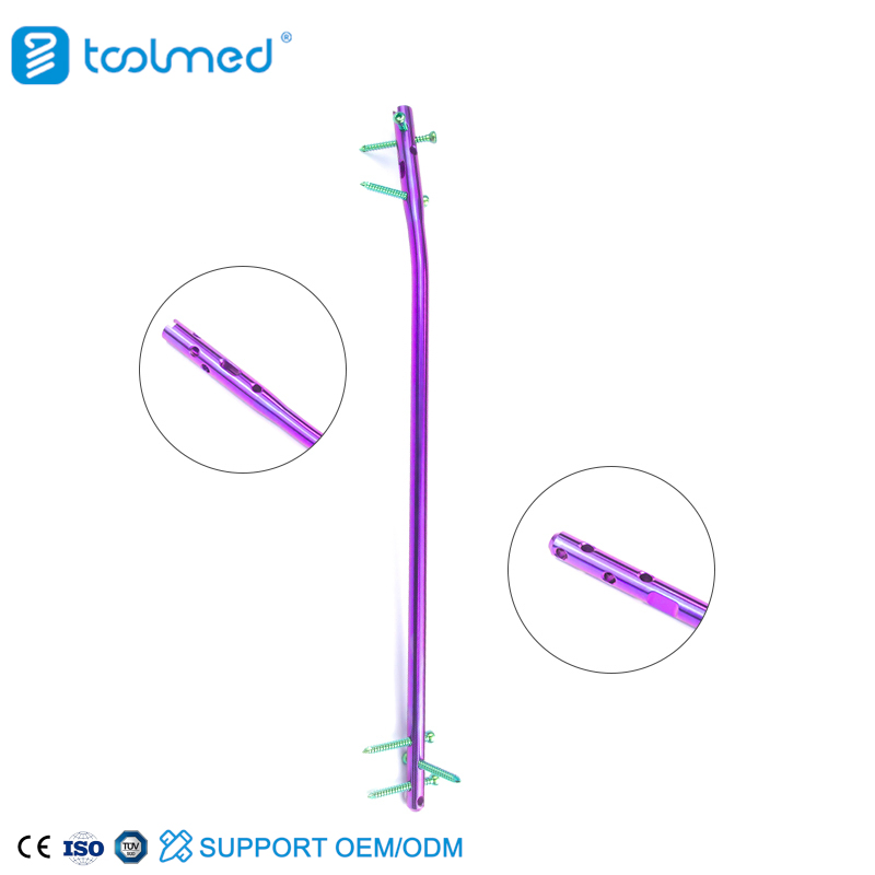 Intramedullary Nailing of Tibia Assured Quality Expert Tibia Intramedullary Nail Instrument Set