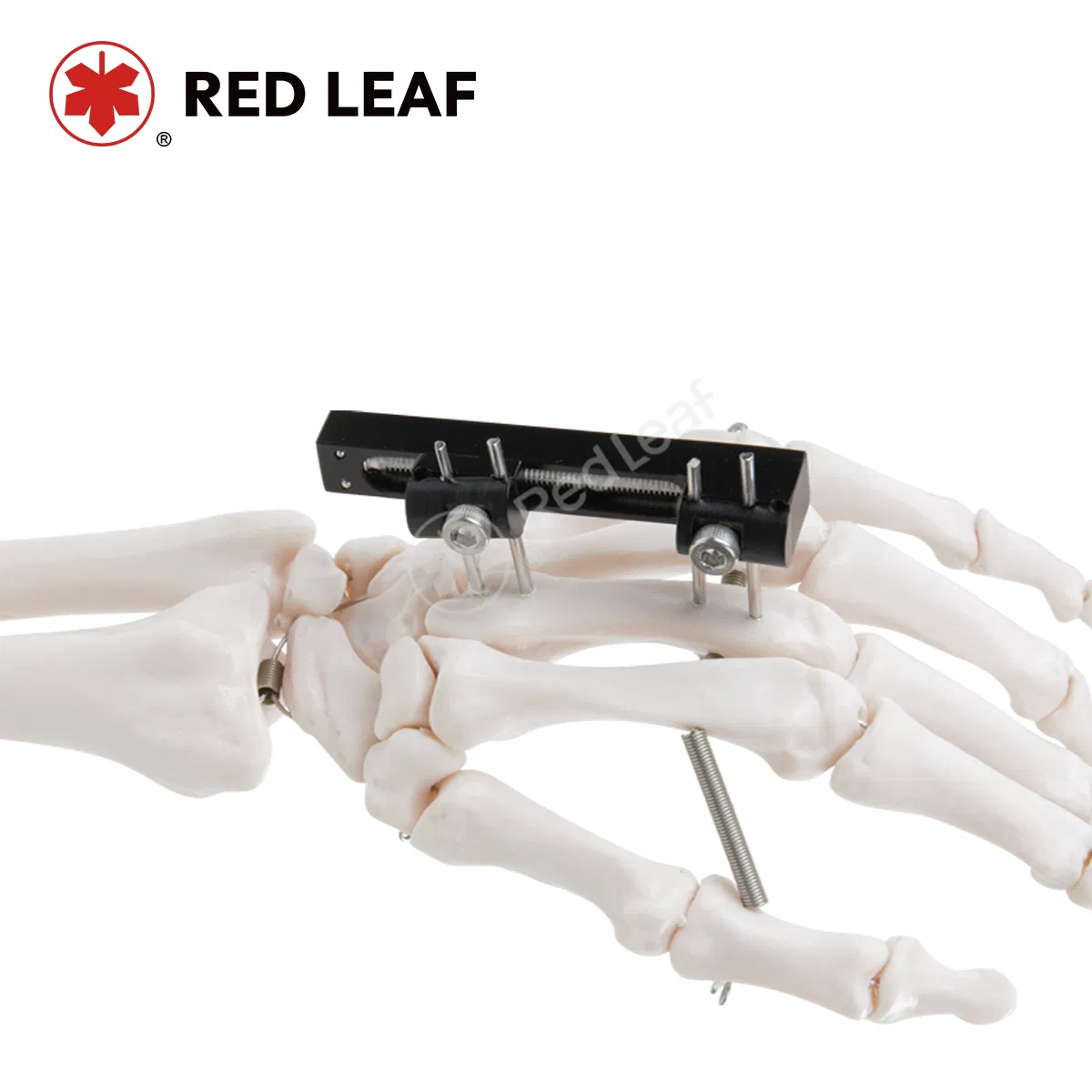 Mini Finger Palm Straight Track External Fixator for Orthopedic Surgical Fracture Fixation