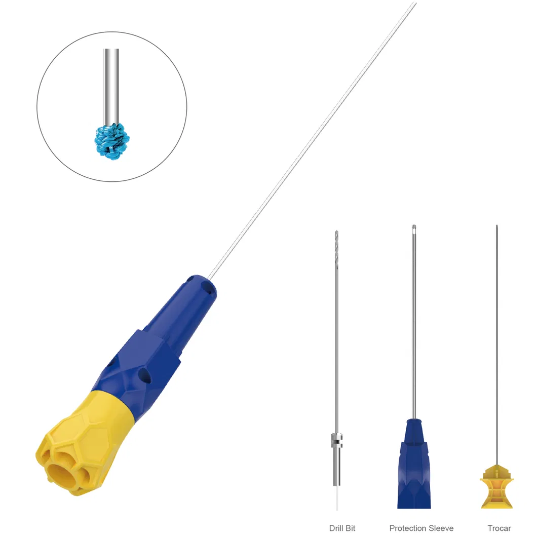 Detailed Suture Anchor View 2