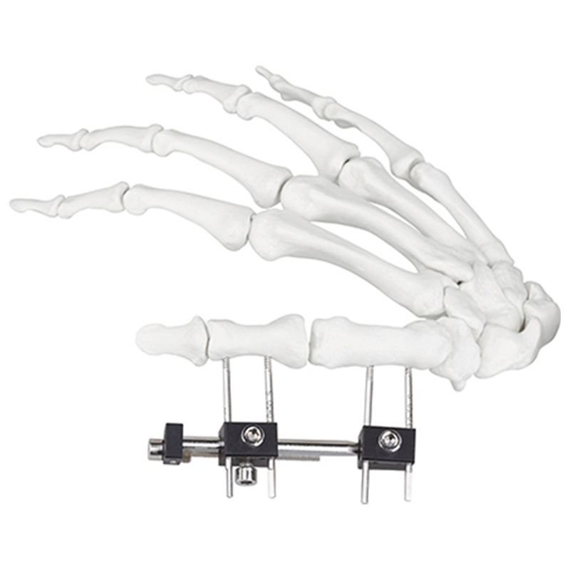 Orthopedic Surgical Instruments Mini External Fixator Joint Motion Type