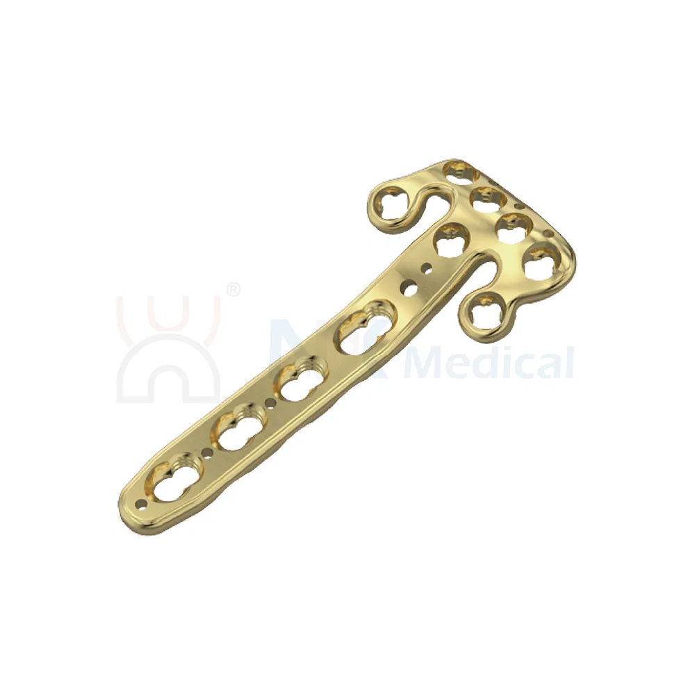 Nx Medical Variable Angle Locking Compression Plate Radius Fragment System for Orthopedic