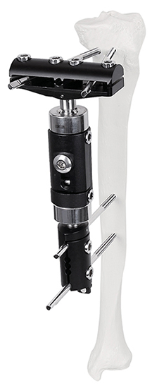 Wrist Fixator External Fixator Fatory Supply