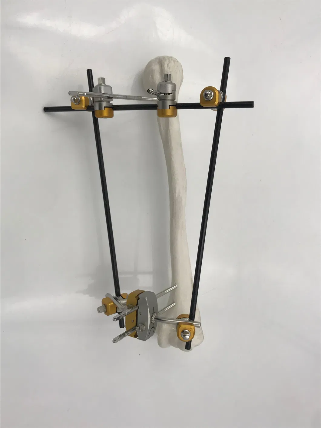 Proximal Humerus Fixator Overview