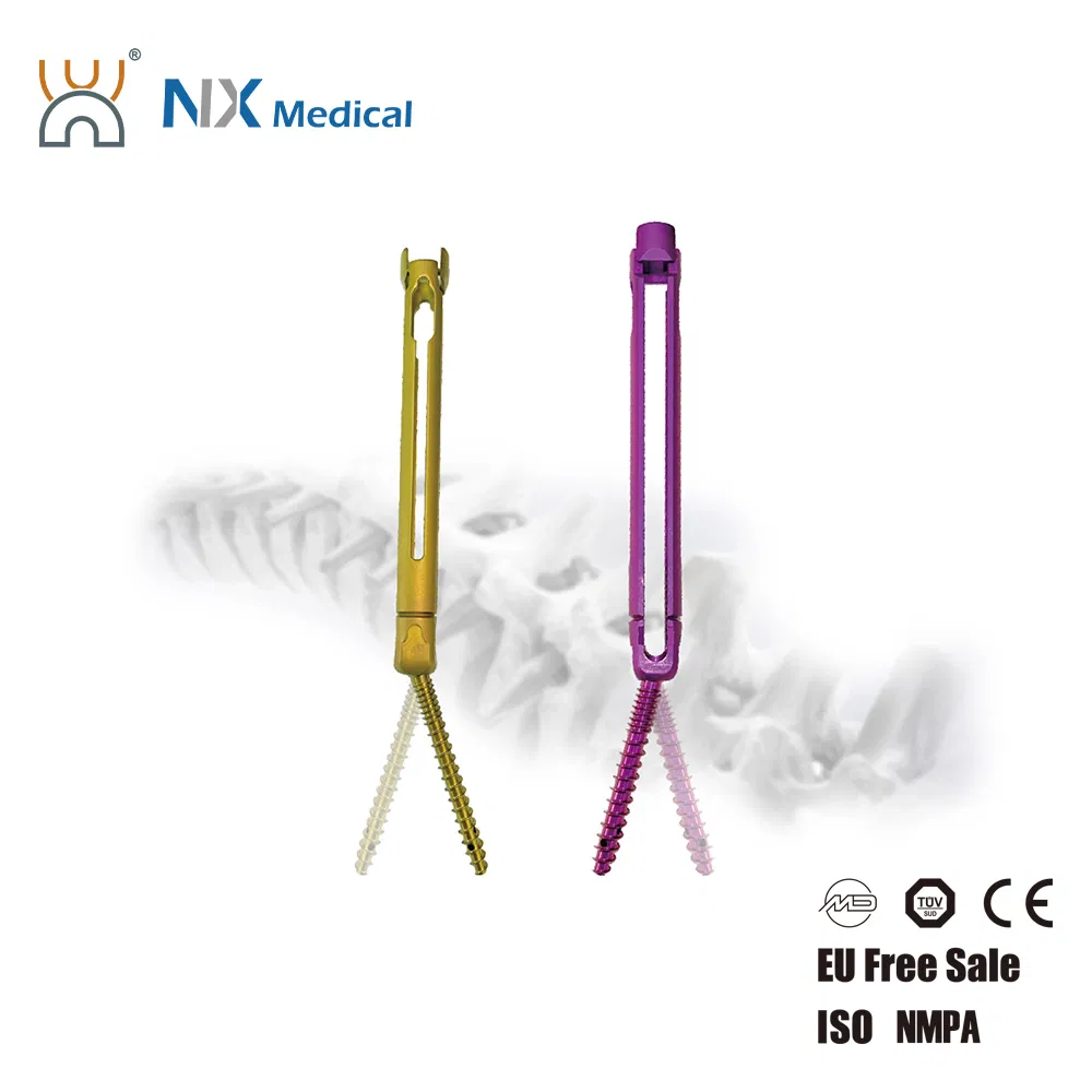 Nx Medical Orthopedic Implant Cannulated Bone Cement Titanium Spinal Pedicle Screw 5.5mm