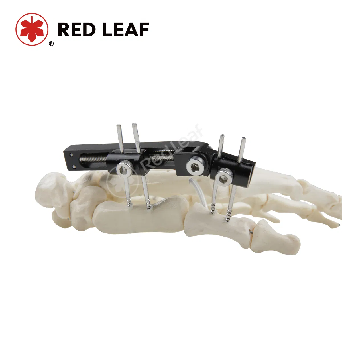 Orthopedic Finger Fracture External Fixator Surgical Instrument Track Vertical Axis Type Fixation