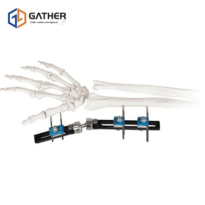 Non Sterilized Package Surgical Instrument Fixation Factory Price External Fixator