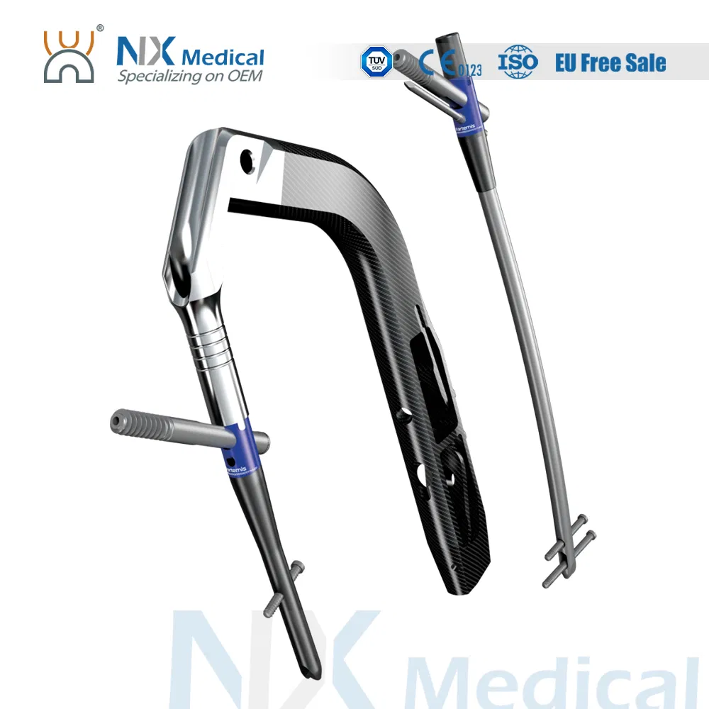 Nx Medical Interlocking Intramedullary Femoral Nail Titanium Orthopedic Implants