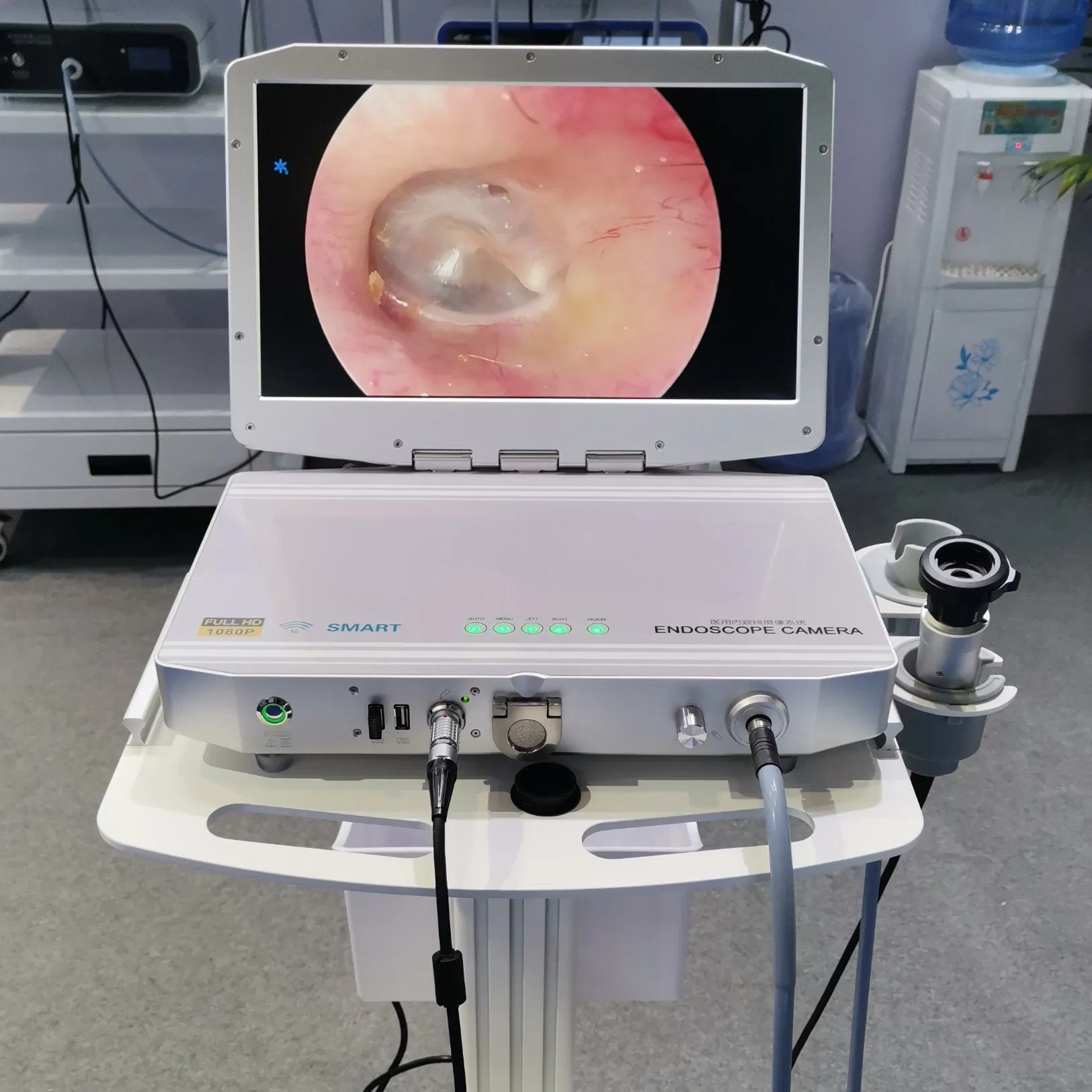 Tj-268A Sistema de Cámara Endoscópica Portátil 3-in-1 Máquina Integrada para Cirugía Urológica en Clínica