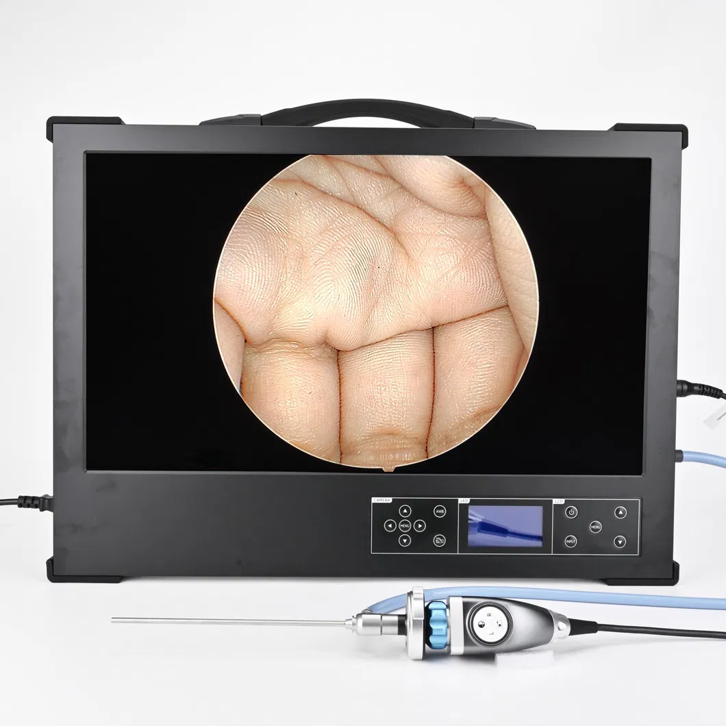 Sistema de Cámara de Endoscopia Integrada Tres en Uno con Monitor de 24 Pulgadas