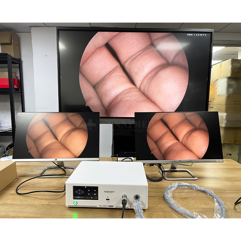 Sy-PS048t Diseño Integrado de Fuente de Luz Fría LED y Cámara Dos en Uno Sistema de Endoscopia Full HD