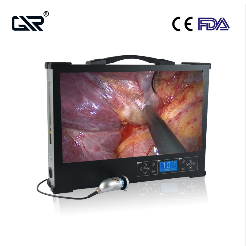 Sistema de Cámara de Endoscopia Integrada Tres en Uno con Monitor de 24 Pulgadas