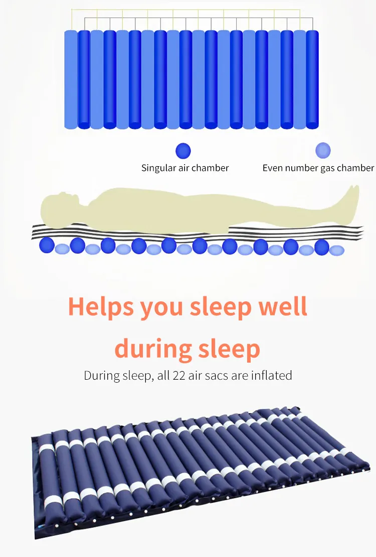 Anti-Bedsore Mattress View 3