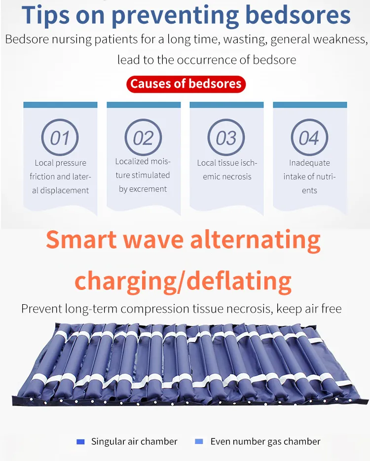 Anti-Bedsore Mattress View 2