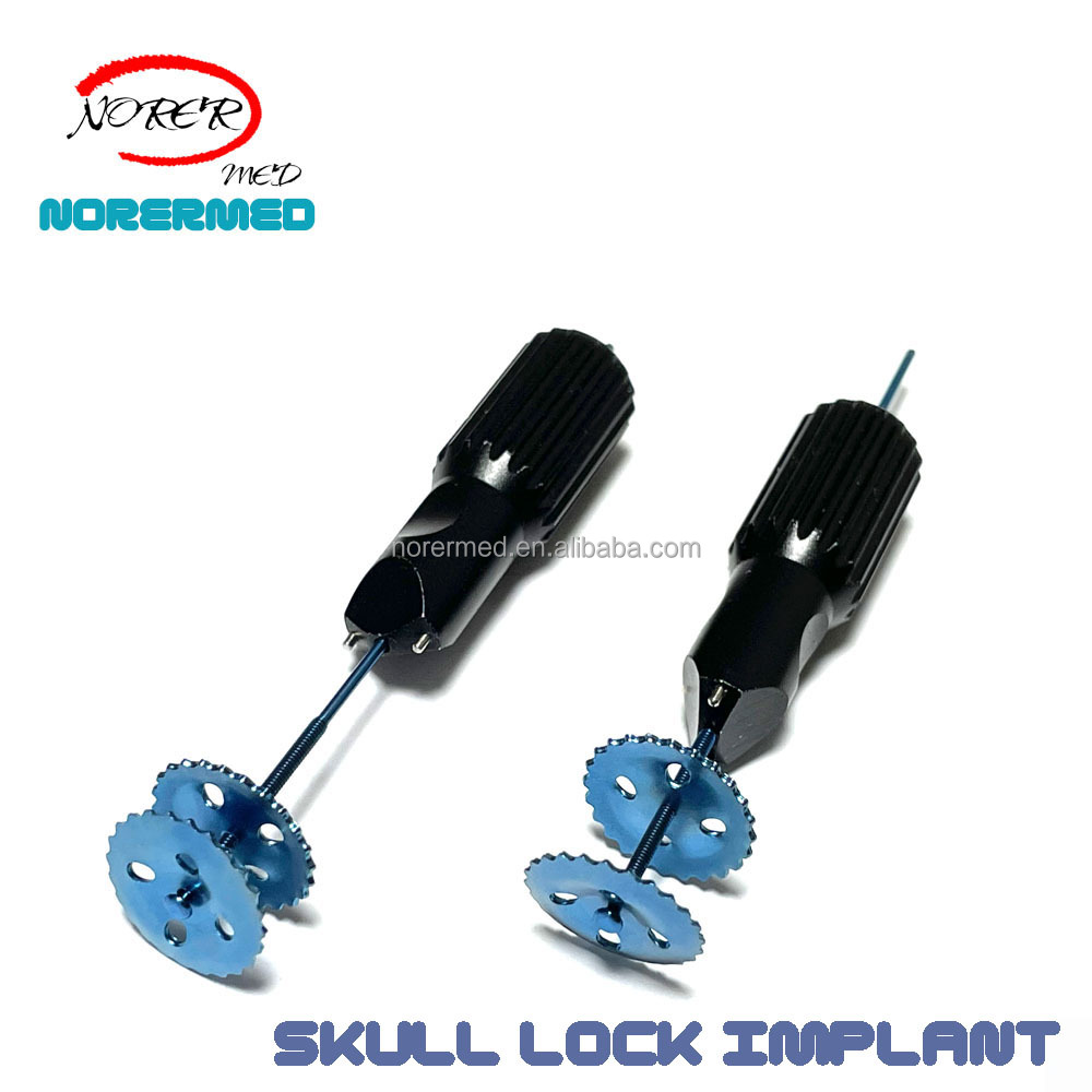 Titanium Skull Lock Implant Detail