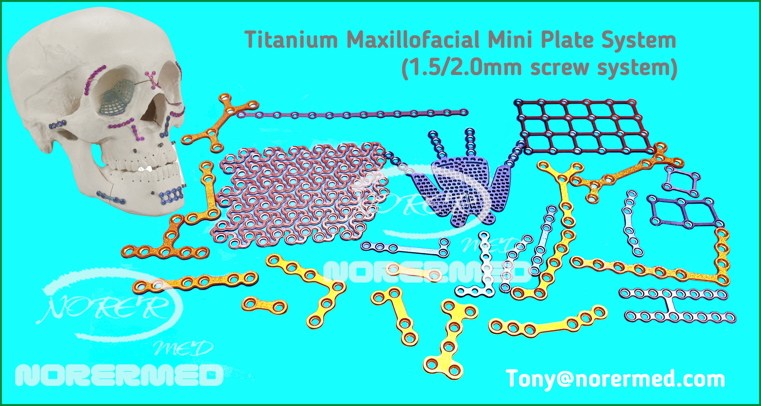 Titanium Skull Lock Implant Components