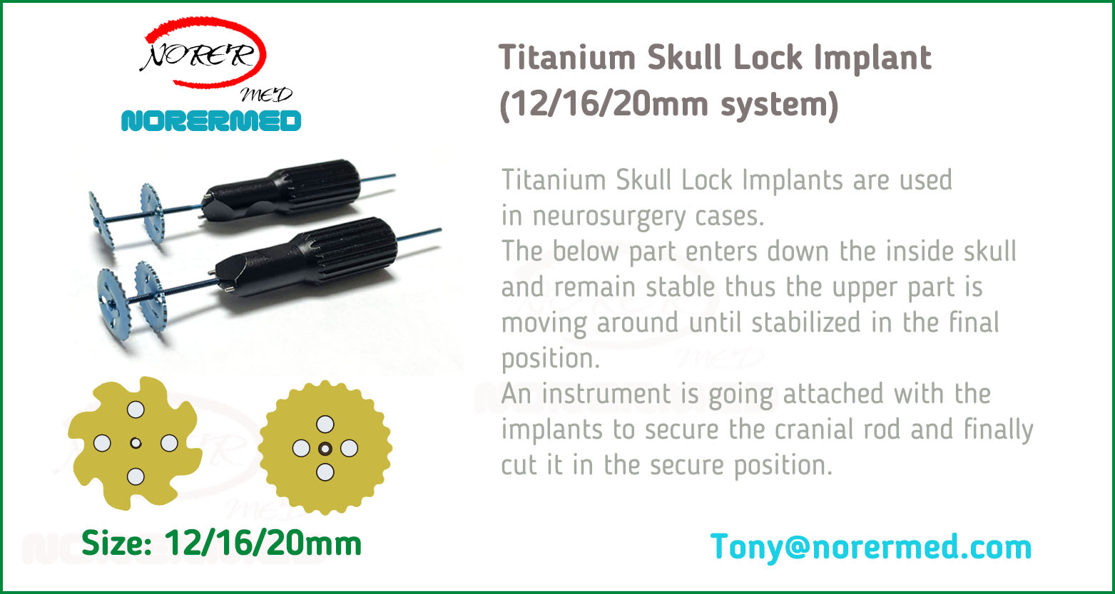 Titanium Skull Lock Implant