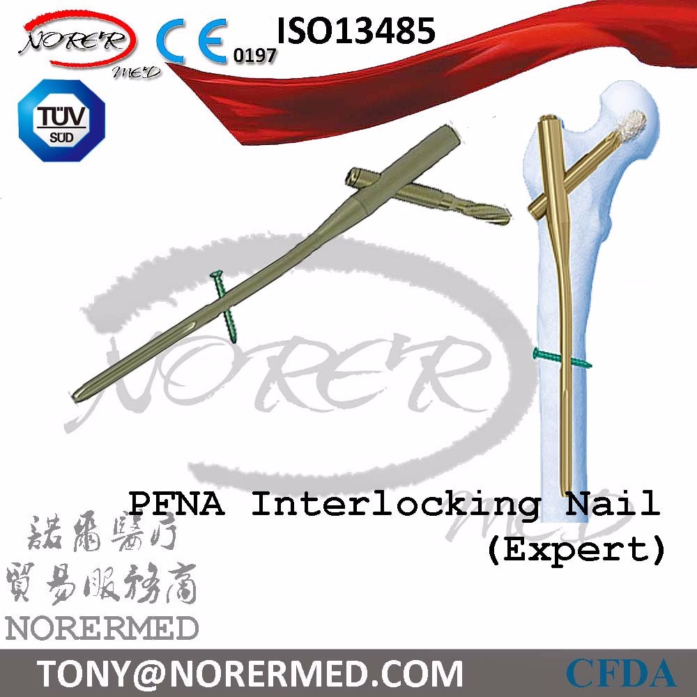 Titanium Orthopedic PFNA Interlocking Nail Show