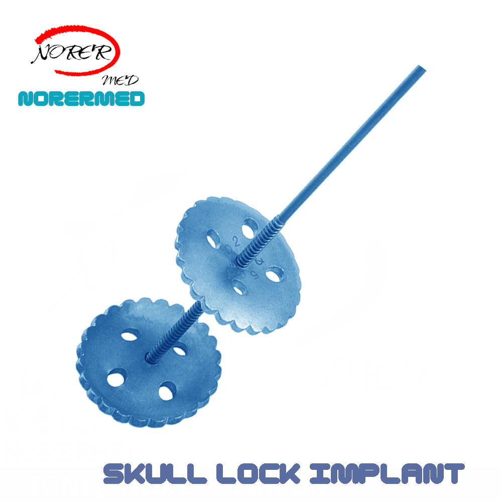 China Manufacturer Titanium Cranial Skull Lock for Skull Implant Surgery