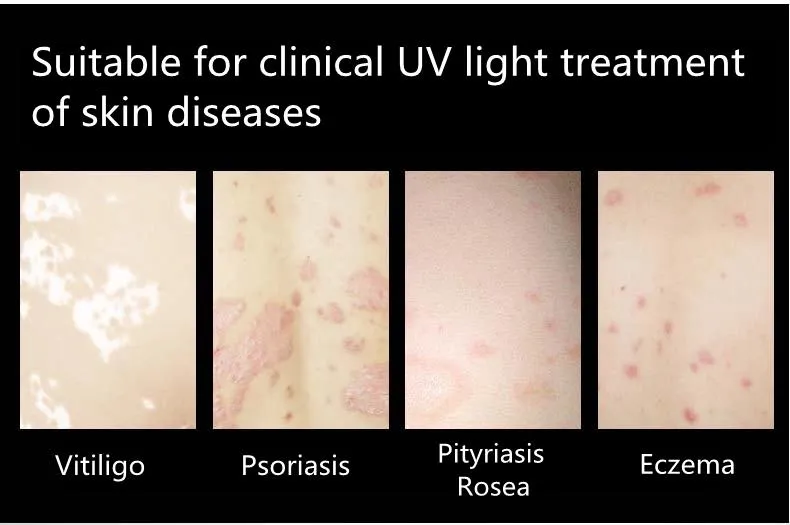 Treatment Function 1