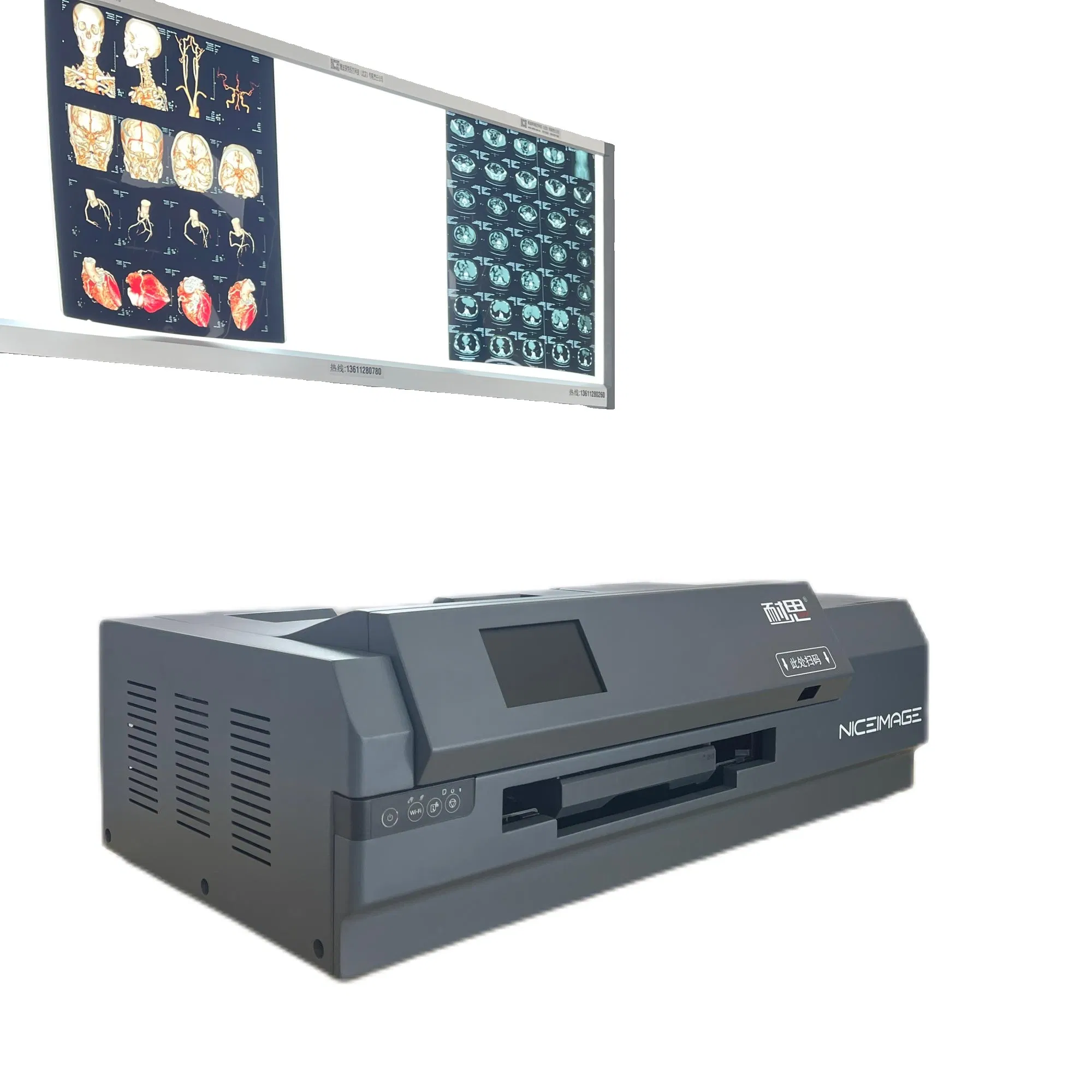 Advanced Digital Medical Inkjet Printing System for Comprehensive CT/Cr/Dr Diagnostics
