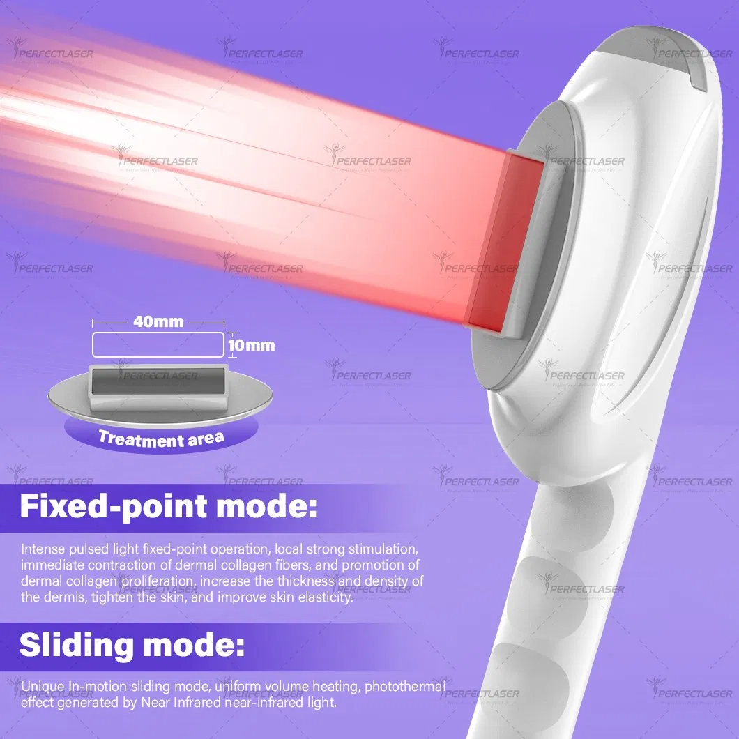 Equipamento de Beleza a Laser para Remoção de Pelos Vascular IPL de Qualidade 3 Comprimento de Onda ND YAG
