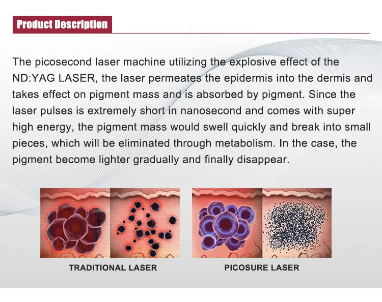 Equipamento de beleza para remoção de tatuagens