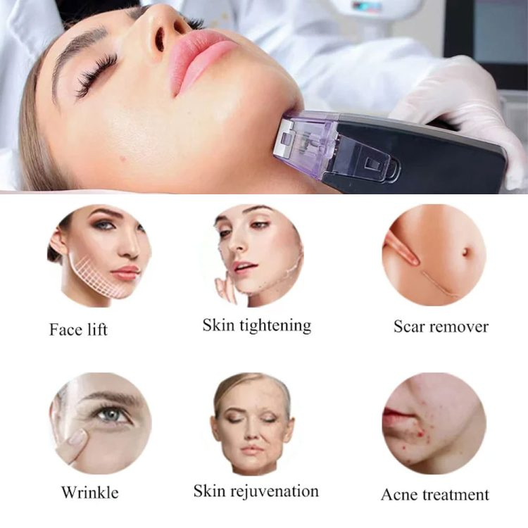 Dispositivo de Beleza para a Pele com Microneedling RF de Profundidade de Cristal Portátil 8