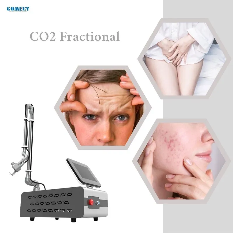 Dispositivo de Rejuvenescimento Facial com Laser para Eliminação de Rugas