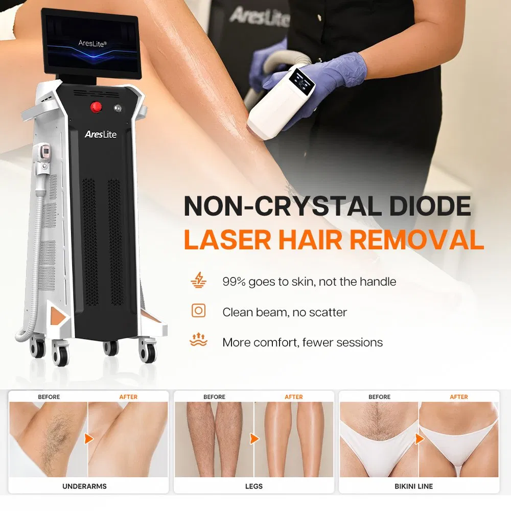 Máquina de Remoção de Pelos a Laser Diodo Painless com Ondas de Titânio Gelo Não Invasiva Winkonlaser CE FDA para Salões 4 755 808 1064 940nm